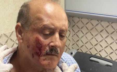 إصابة مواطنين في هجوم للمستوطنين شرق نابلس