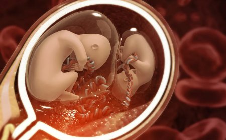 جراحة نادرة: استئصال توأم غير مولود من دماغ طفل يبلغ من العمر سنة واحدة في الصين