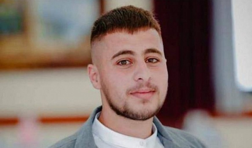 شهيد و3 إصابات خطيرة برصاص الاحتلال في حلحول